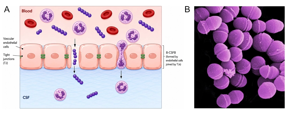 Illustration of GBS meningitis